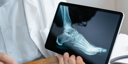Digital X-Ray